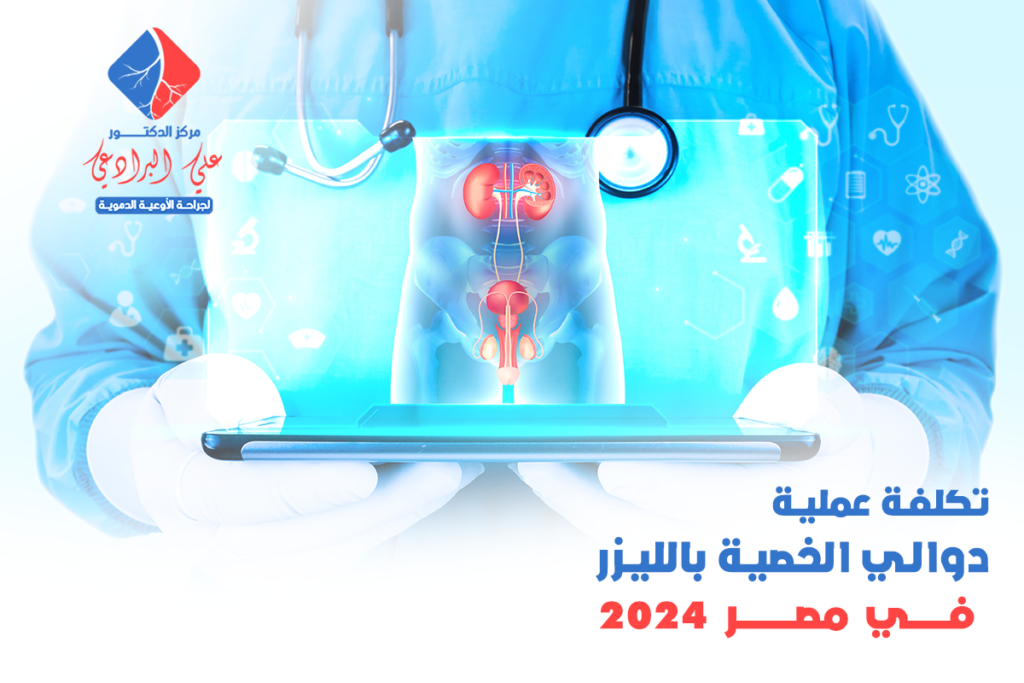 تكلفة عملية دوالي الخصية بالليزر