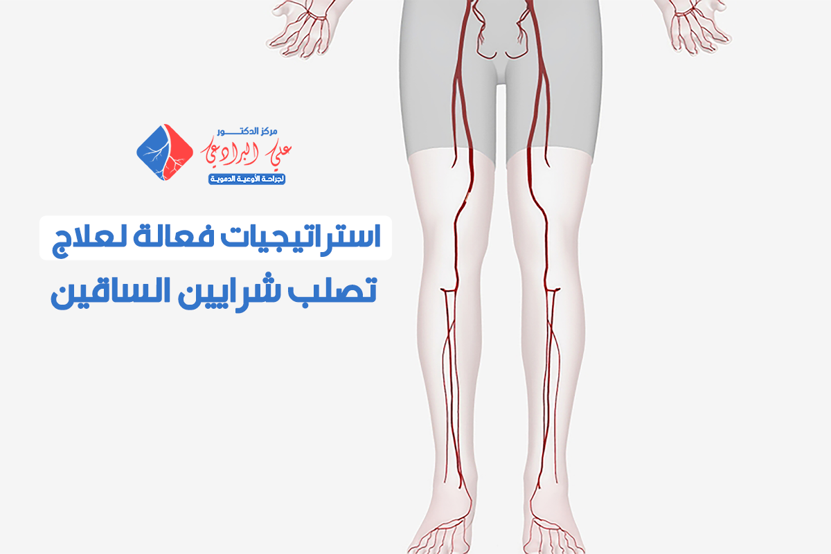 علاج تصلب شرايين الساقين​