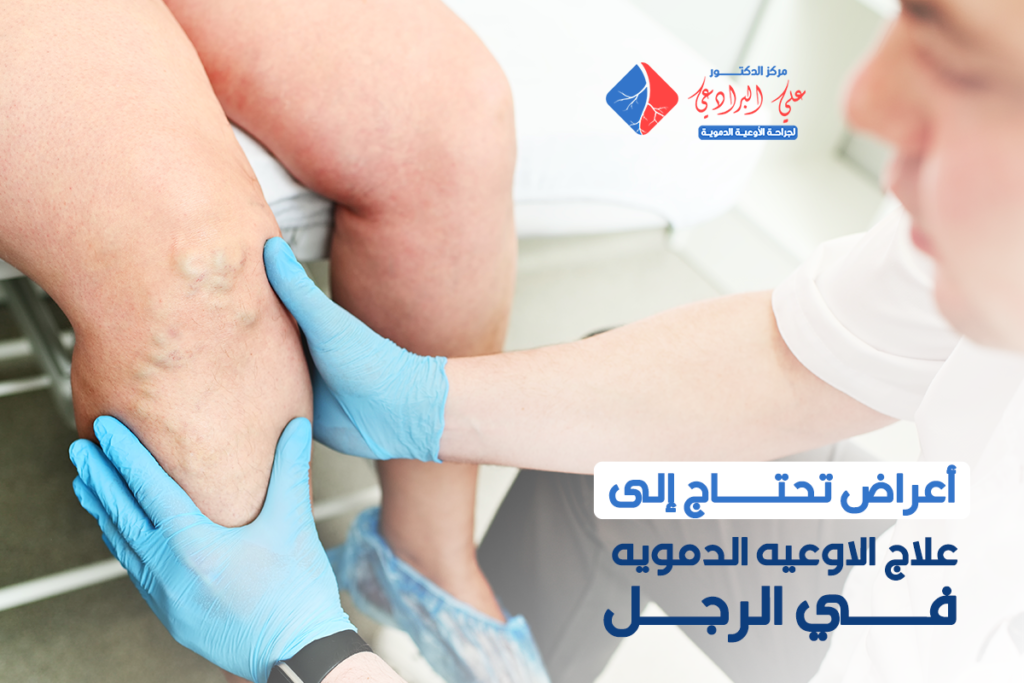 علاج الاوعيه الدمويه في الرجل​