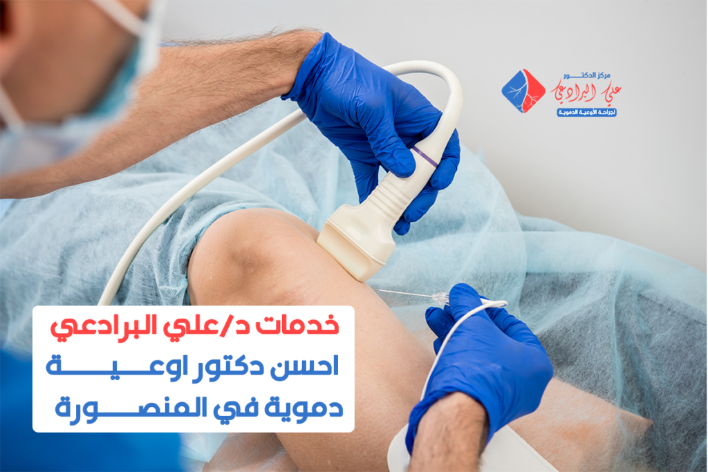 احسن دكتور اوعية دموية في المنصورة​