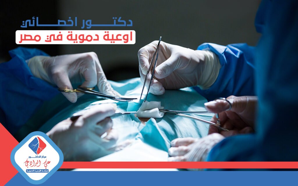 دكتور اخصائي اوعية دموية في مصر