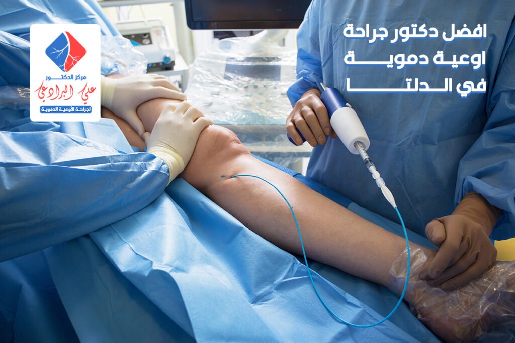 دكتور جراحة اوعية دموية في الدلتا