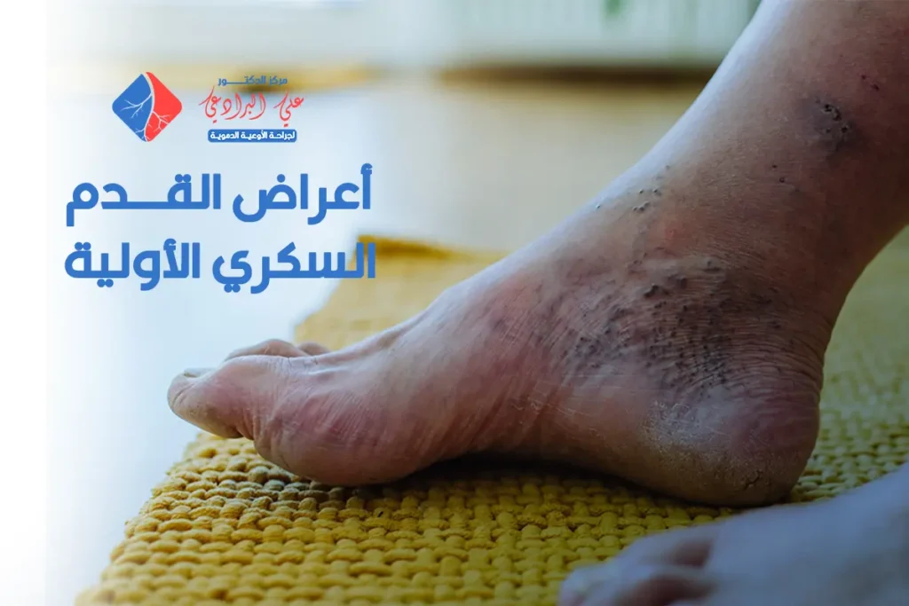 أعراض القدم السكري الأولية (3)