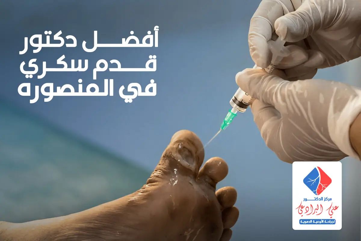 أفضل دكتور قدم سكري في المنصوره (3)