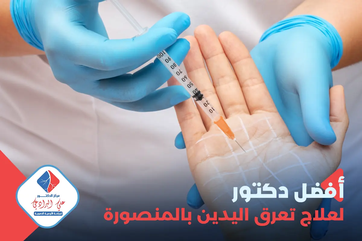 أفضل دكتور لعلاج تعرق اليدين
