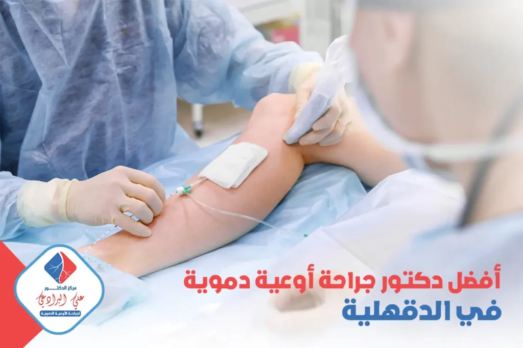 افضل دكتور جراحة أوعية دموية في الدقهلية