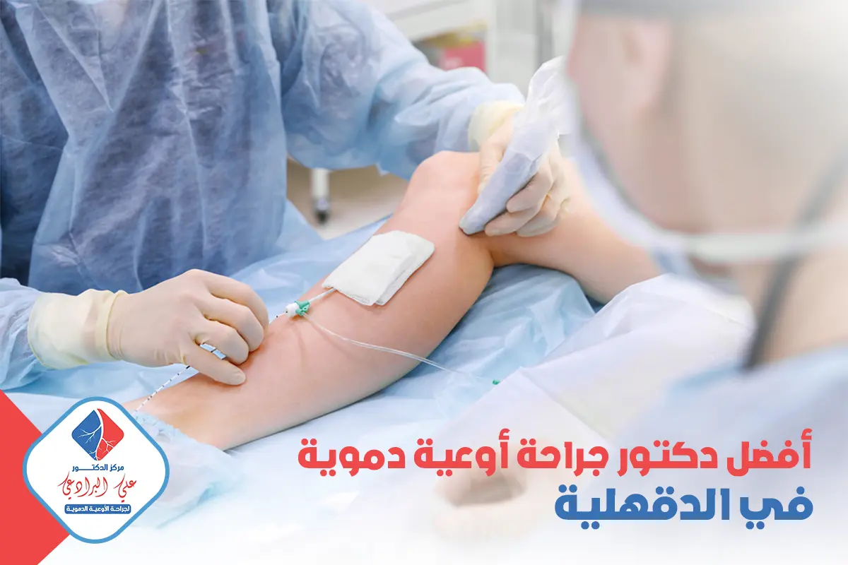 افضل دكتور جراحة أوعية دموية في الدقهلية