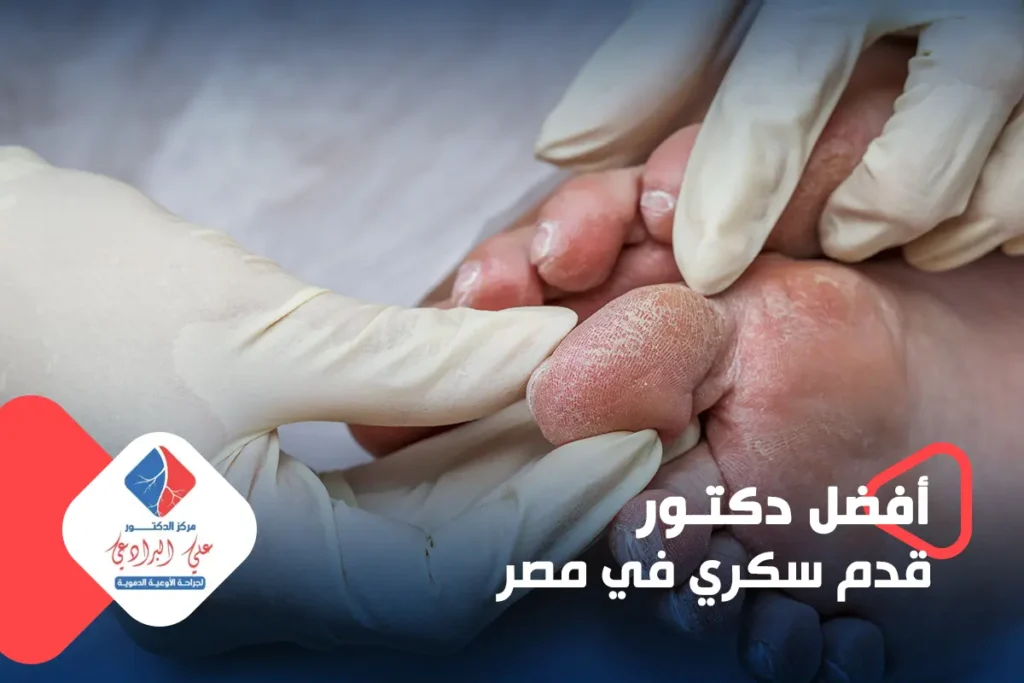 افضل دكتور قدم سكري في مصر