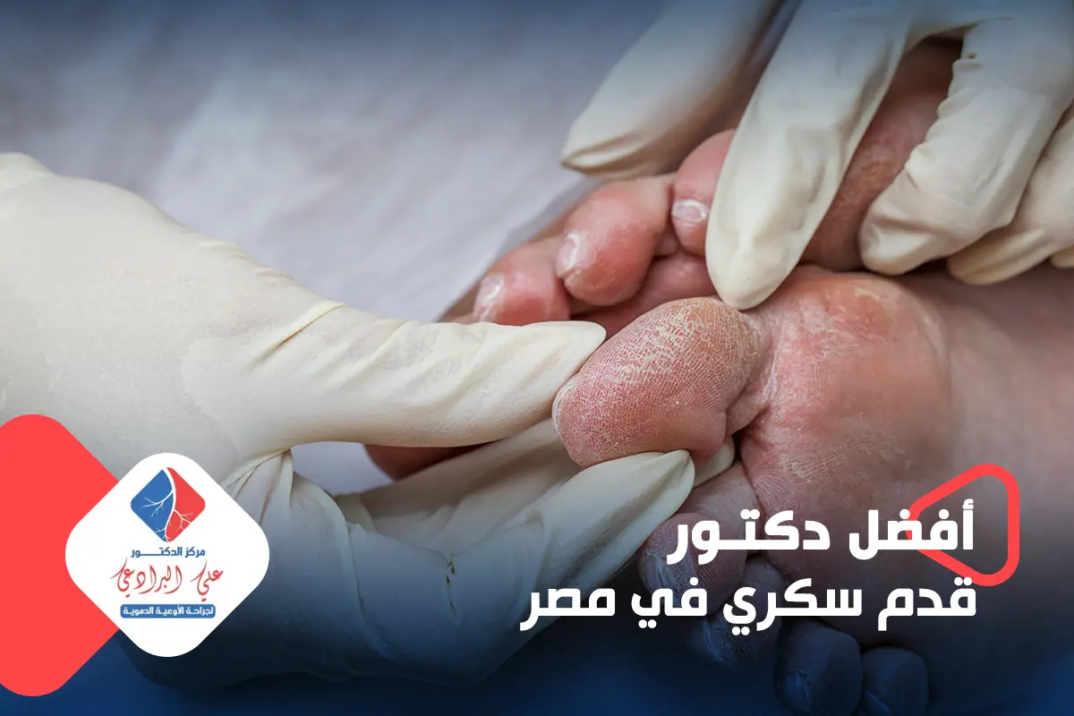 افضل دكتور قدم سكري في مصر