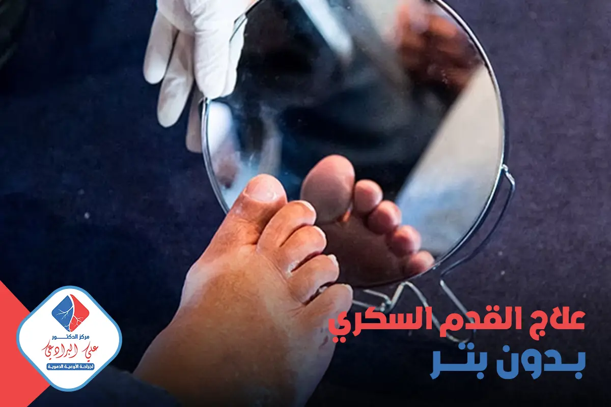 علاج القدم السكري بدون بتر (3)