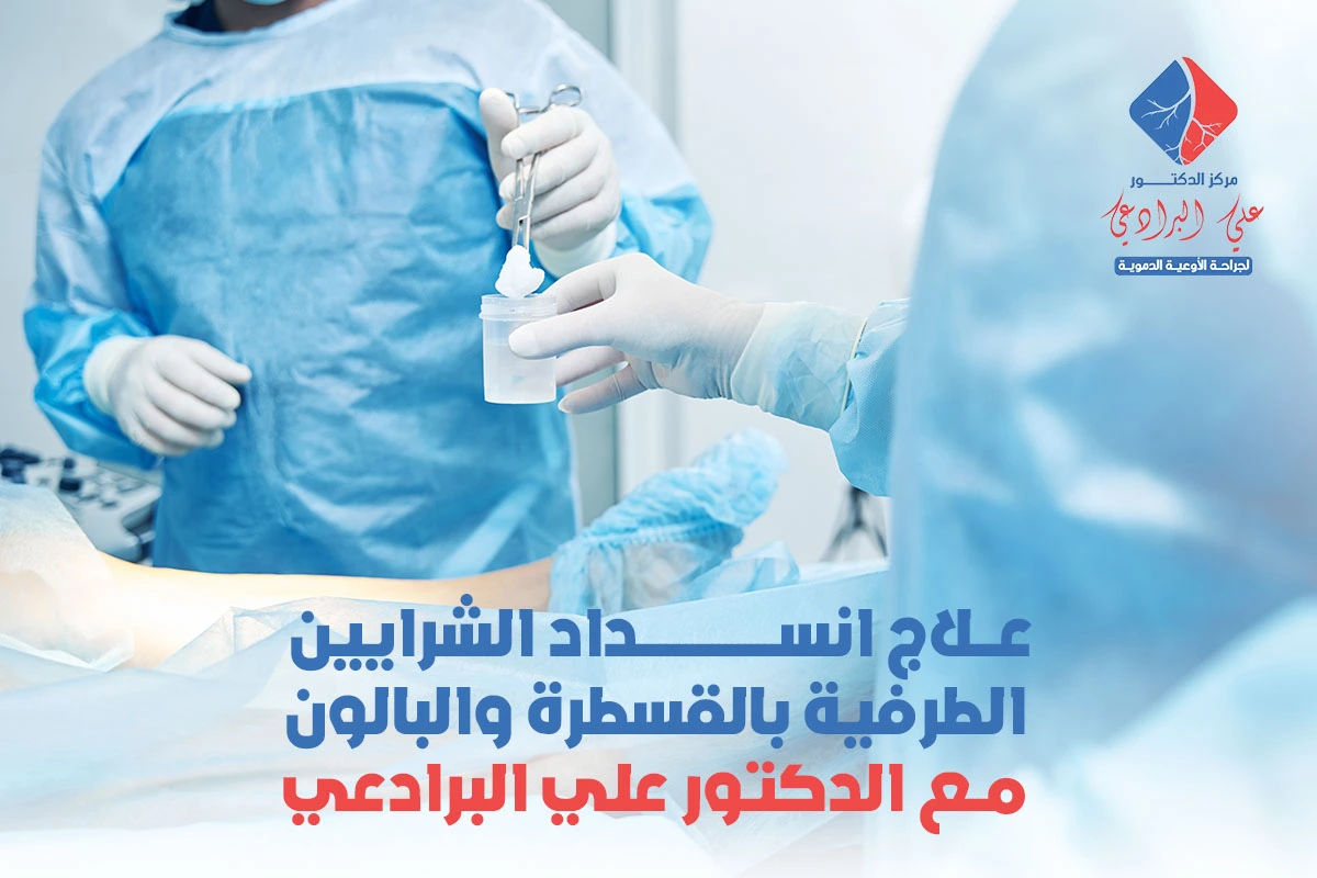 علاج انسداد الشرايين الطرفية بالقسطرة والبالون